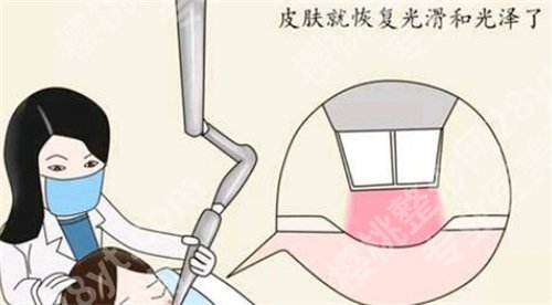 韩东亮医生切除疤痕怎么样？一键查看医生信息