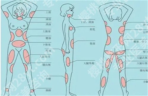 李旭东医生吸脂怎么样？医生实力介绍