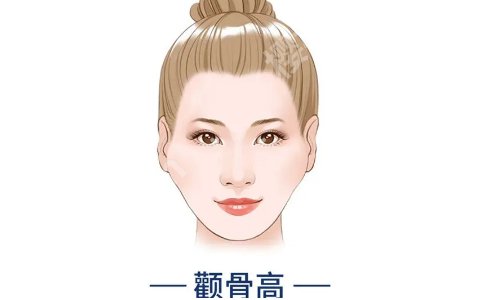 黄敬夏颧骨内推做得怎么样？医生简介、网友反馈一览