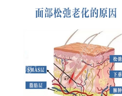 上海马昌华医生拉皮贵吗？明星介绍