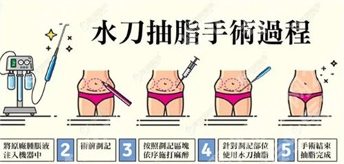 王衡健吸脂咋样?医生技术、口碑点评来袭