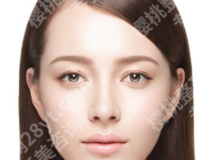 亓发芝双眼皮案例怎么样?了解双眼皮案例过程