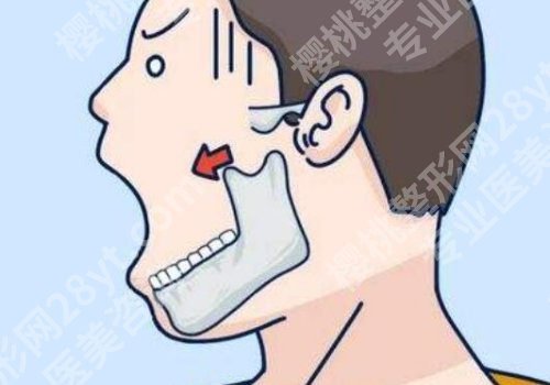 邱立东改轮廓怎么样？医生基本信息、网友反馈、价格表
