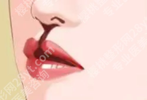 王丹茹唇修复案例已更新！医生介绍、价格表、术后小tips