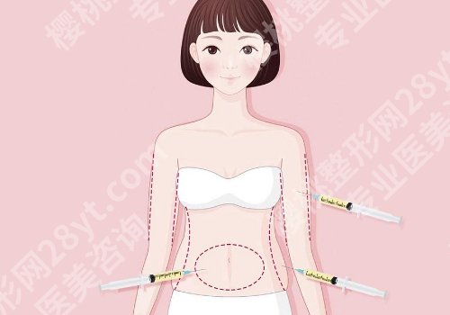 哈尔滨羽禅医美杨宇梓怎么样？医生介绍、价格表、术后小tips