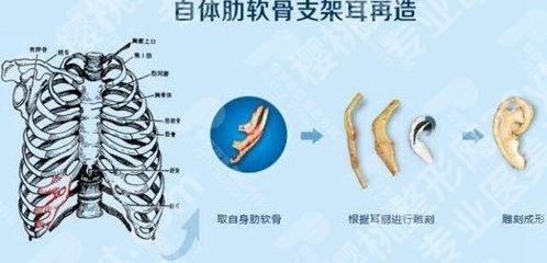 复旦大学附属儿科医院整形外科医生有哪些？董晨彬、李军实力推荐