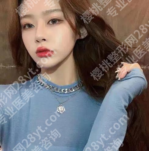 上海孙冲医生做眼睛怎么样？盘点医生资料，附有经典案例案例分享