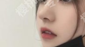 秦皇岛市第一医院整形外科专家哪位技术好？擅长项目科普
