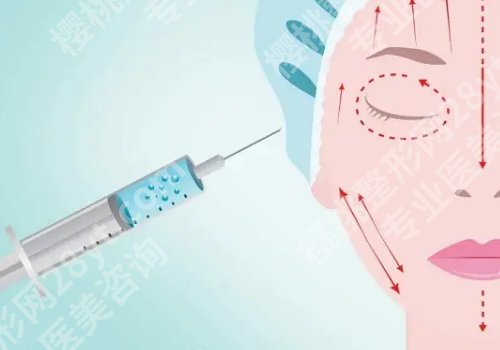 哈尔滨瑞丽的注射瘦脸是真是假？医院真实案例及术后tips一览