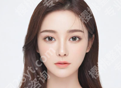 上海伊莱美做下颌缘提升什么价格？下颌缘提升价格为6000元起