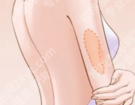 深圳富华医院做鼻子怎么样？主打项目一一分析