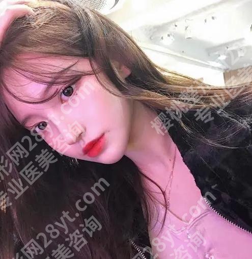 唐红伟做土耳其软糖鼻咋样？速看热门医生信息与详细案例过程曝光