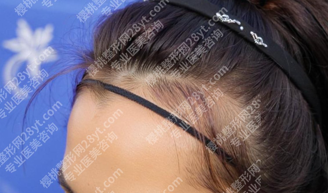 成都丝缘植发医院怎么样?医院地理位置及植发案例参考