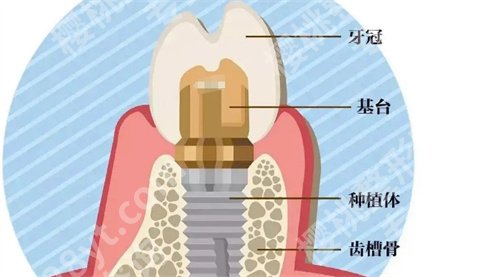普宁人民医院种牙怎么样？医院详情介绍