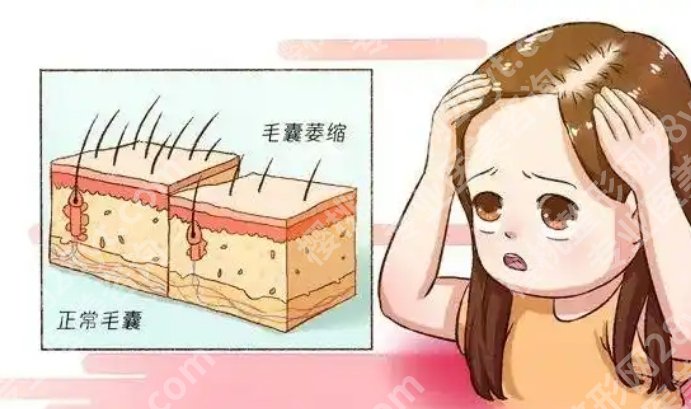 医学科学院整形外科医院植发怎么样？技术在线点评