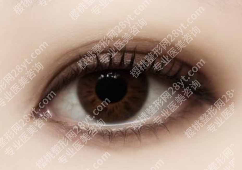 余墨声手术口碑评价如何？双眼皮项目面诊技巧！