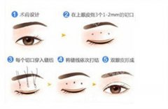 罗旭松口碑怎么样？医生实力曝光