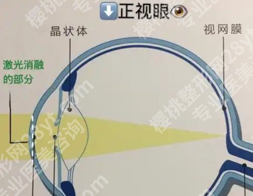 芜湖弋矶山医院激光近视多少钱？医院主打项目
