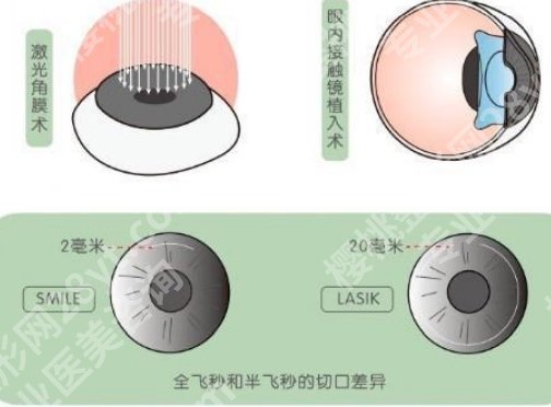 芜湖弋矶山医院激光近视多少钱？医院主打项目