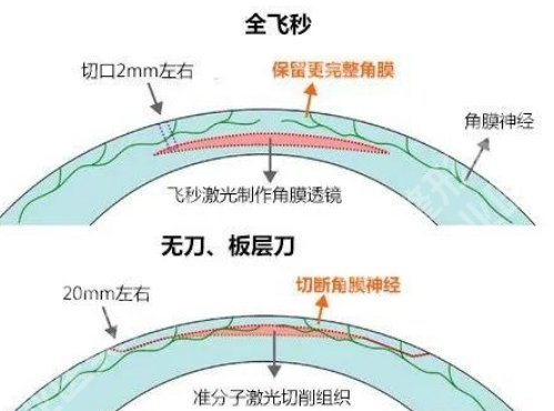 芜湖弋矶山医院激光近视多少钱？医院主打项目