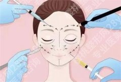 胡小清自体脂肪怎么样？医生基本信息公布