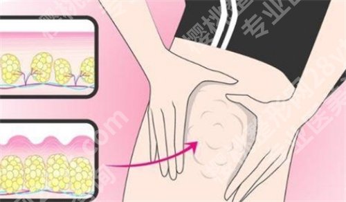 唐鏖案例锦集?医生口碑点评