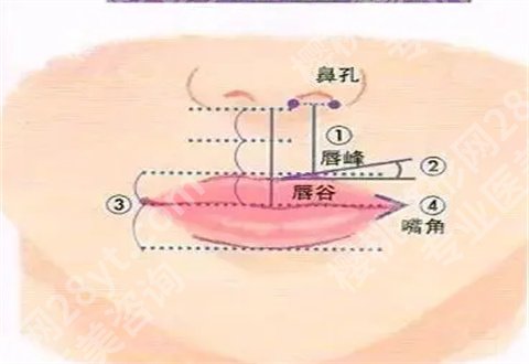 上海卢九宁做M唇怎么样?分享一份案例参考大全