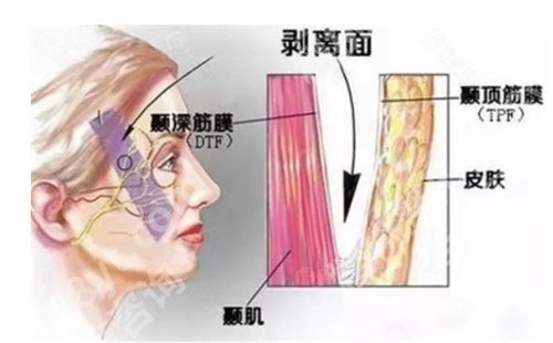 刚拉皮在上海有名气吗？技术点评