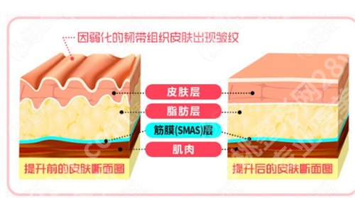 刚拉皮在上海有名气吗？技术点评
