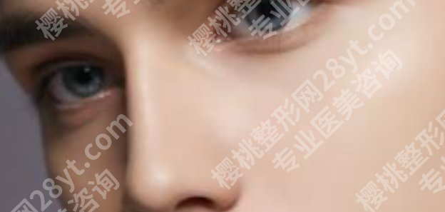邓东伟做鼻子的价格是多少？真实的案例鉴赏！