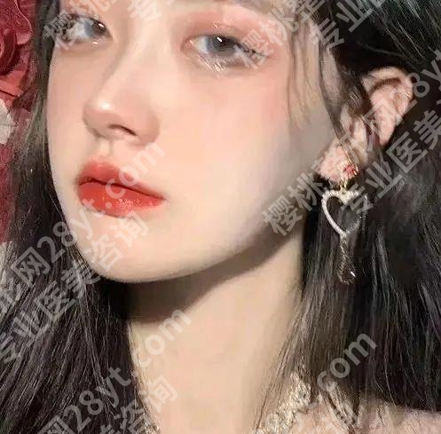 上海张彩云医生双眼皮怎么样?赶紧来来啦人气医生信息一览