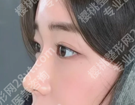 整形外科何家明医生简介怎么样？一键了解热门医生资料