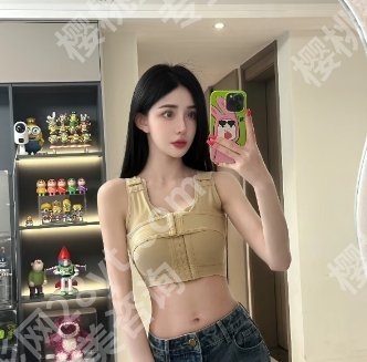 罗盛康隆胸怎么收费？真实的技术如何？戳进来看口碑点评