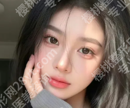 上海杨杰医生鼻整形怎么样？一览查看医生顾客点评详情