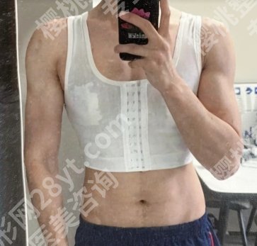 上海九院何金光做男性乳房手术多少钱？特色项目科普！