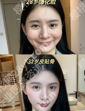 蒋铮铮馒化脸修复怎么样？医生坐诊医院及个人点评来袭