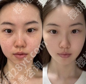 武汉濡白天使授权医生名单分享！朱胜军、胡煜、董海燕等技术可靠！