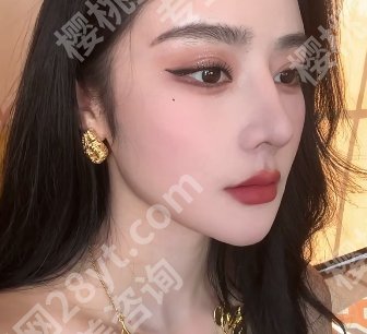 段焘和邓东伟谁厉害？坐诊医院及实操隆鼻案例参考
