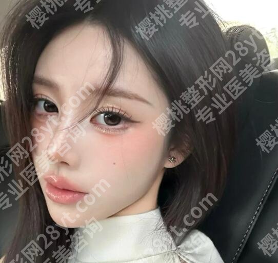 段焘鼻子怎么样？技术好风格也自然！真人案例图展示！
