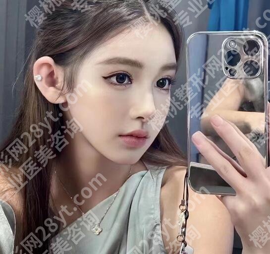 成都八大处医疗美容医院怎么样？医院口碑评价+隆鼻案例图反馈！