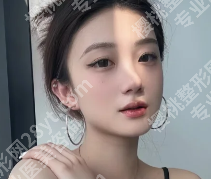 上海张宇医生擅长什么类型双眼皮？含顾客点评一览