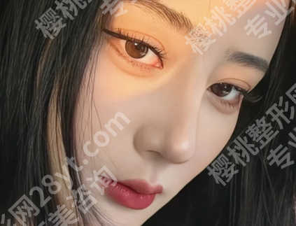 尚英彬医生祛斑好吗？个人医生简介_热门项目了解