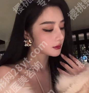 成都周柯做修复鼻怎么样？坐诊医院及鼻修复案例参考
