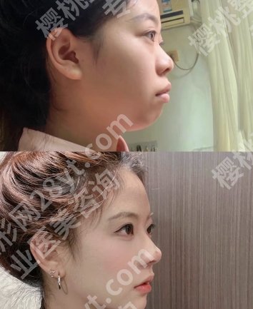 北京维恩维口腔门诊部怎么样？坐诊医生及热门项目介绍！