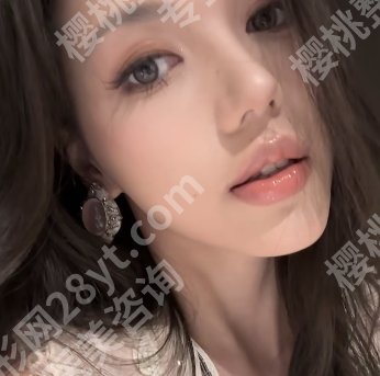 上海安缦医疗美容鼻子价格贵不贵？隆鼻后效果可维持多久？实例来袭