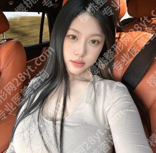 万友望脂肪丰胸案例图展示！见证她的美丽蜕变！戳进来看