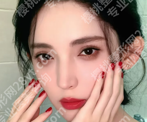 张如鸿做的耳朵疤痕怎么样？附人气医生简介_经典案例分享
