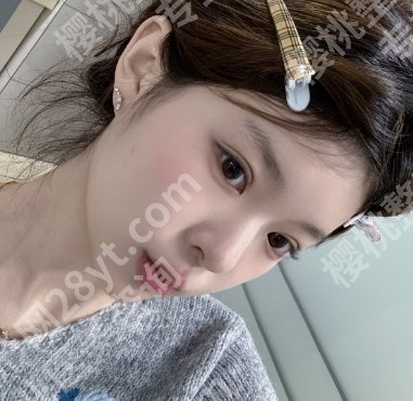 临沂市人民医院整形美容科怎么样？院内坐诊医生及案例参考