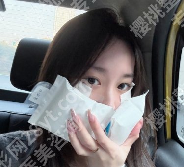 上海国际医院点阵激光多少钱？医院交通导航及到院须知分享！