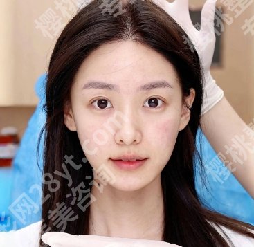 广医三院美容整形科好吗？医院口碑医生及热门项目价格参考